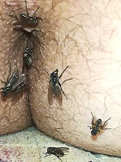 Flies on my anus in the village.  06. 2025
