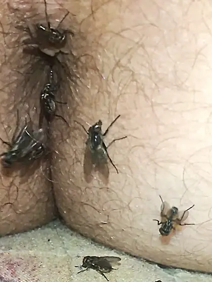 Flies on my anus in the village.  06. 2025