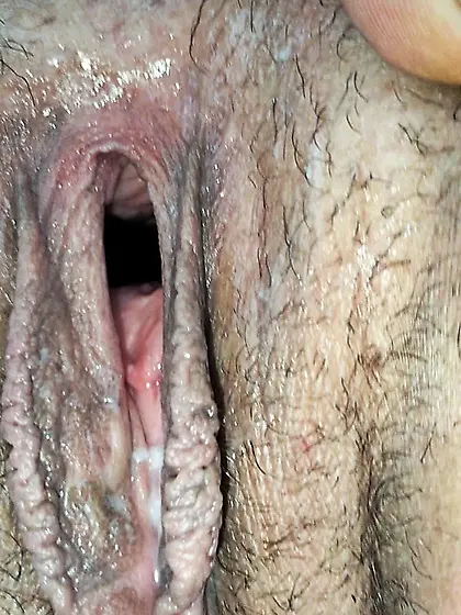 Cum covered cervix