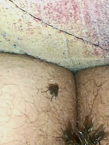 Flies on my anus in the village.  06. 2025