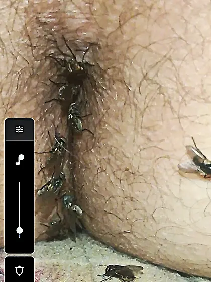 Flies on my anus in the village.  06. 2025