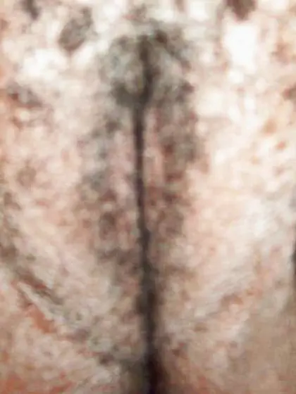 PLUMPER Mental Case LaToya