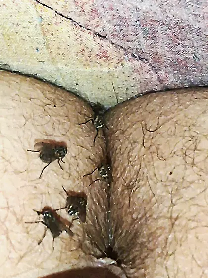 Flies on my anus in the village.  06. 2025
