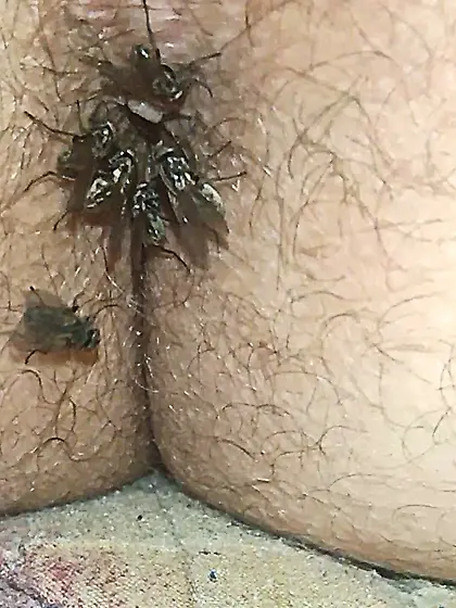 Flies on my anus in the village.  06. 2025