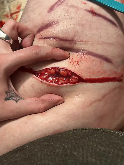 more knife play,  this time with a scalpel