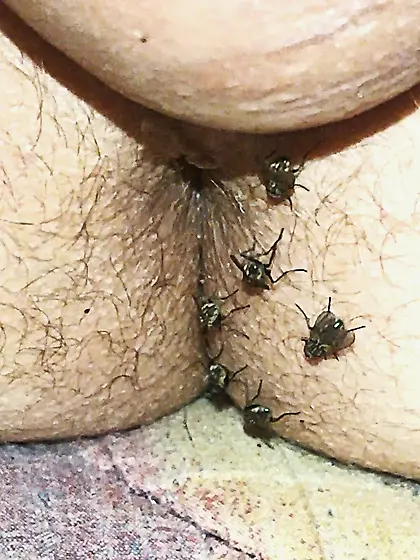 Flies on my anus in the village.  06. 2025