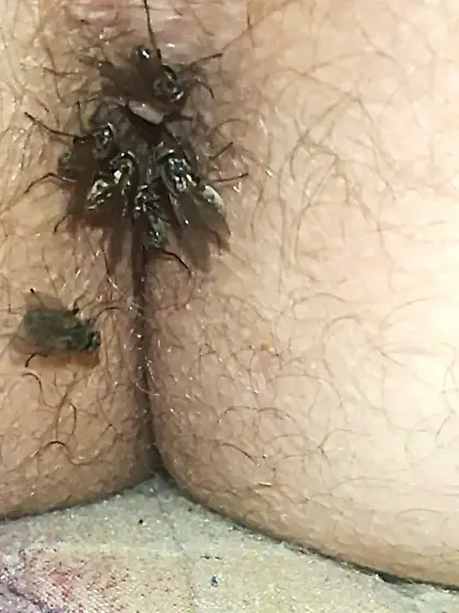 Flies on my anus in the village.  06. 2025