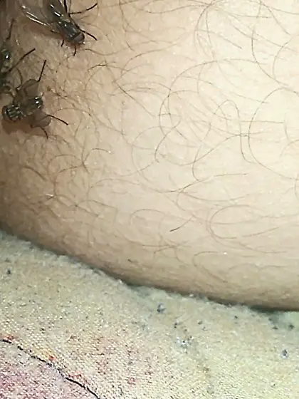Flies on my anus in the village.  06. 2025