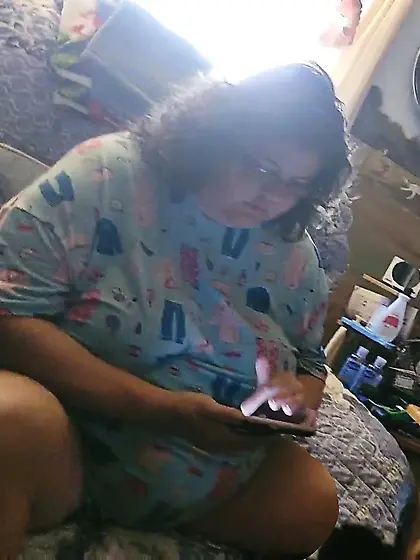 Amputee Kay wants attention