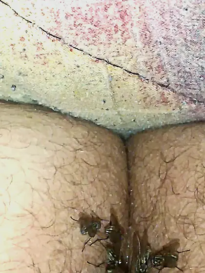 Flies on my anus in the village.  06. 2025