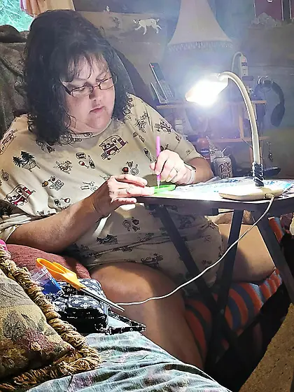 Amputee Kay wants attention