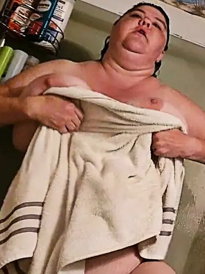 Amputee Kay wants attention