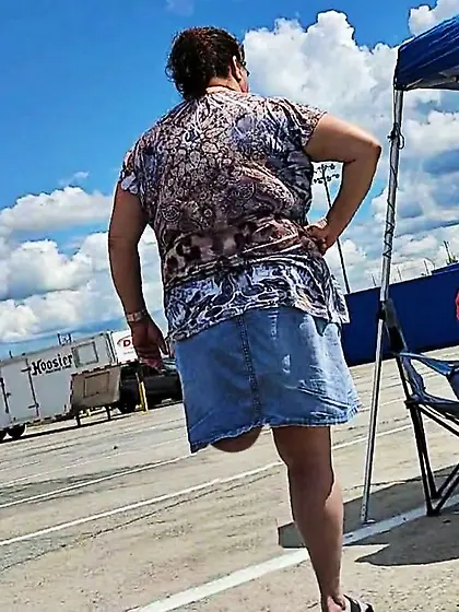 Amputee Kay wants attention