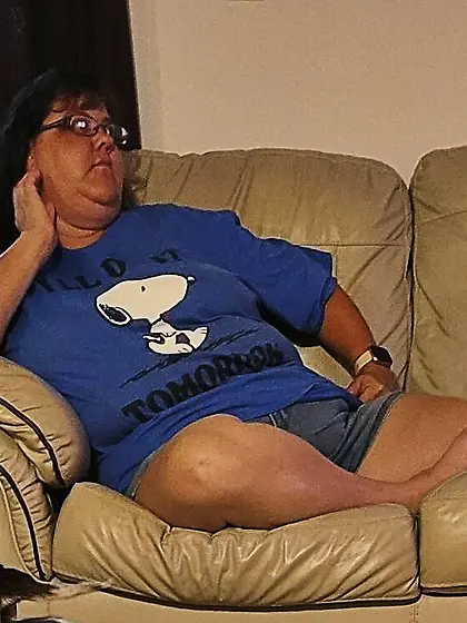 Amputee Kay wants attention