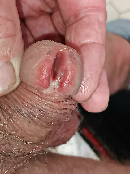 Finally split my cock from my piss hole to my PA