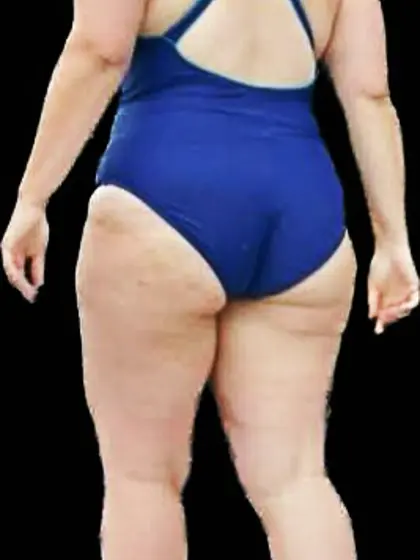 Dolly « beach « Extra