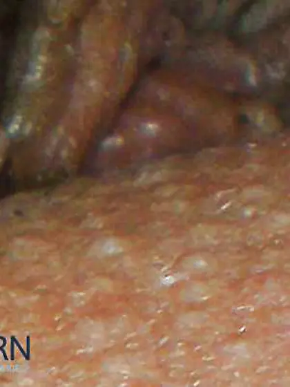 Amandas butthile legal years and 1 month old