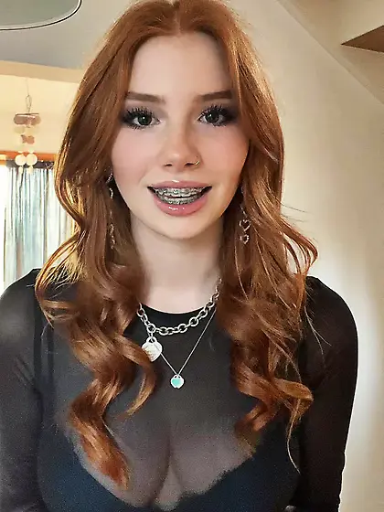 braces