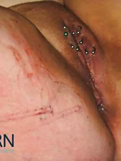 Crimson and deep throated