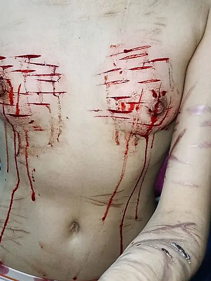 Beautiful Small Breast being cut aftermath