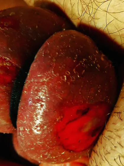 Ball burning,  great fun