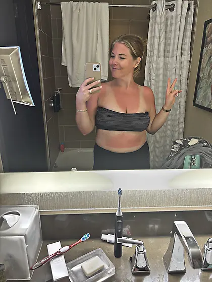 She a cutie sun burnt