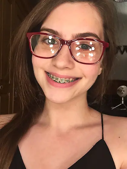 braces