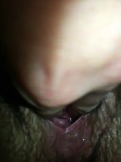Big Pussy Lips Huge Labia Large Vagina