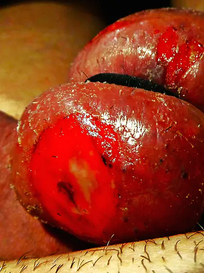 Ball burning,  great fun