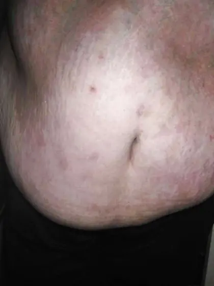 My spectacular plumper wifey stomach