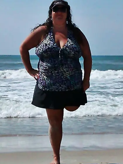 Amputee Kay wants attention