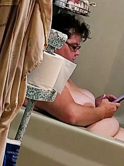 Amputee Kay wants attention