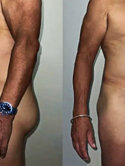 My semi erect tiny dick