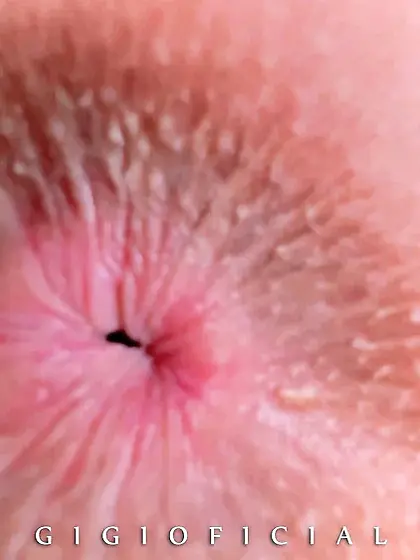 How looks like gape of butthole while girls farting?