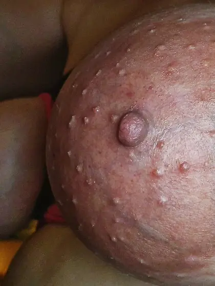 Meine Brueste, Bubi, Titten