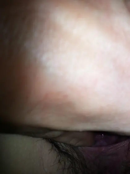 Big Pussy Lips Huge Labia Large Vagina