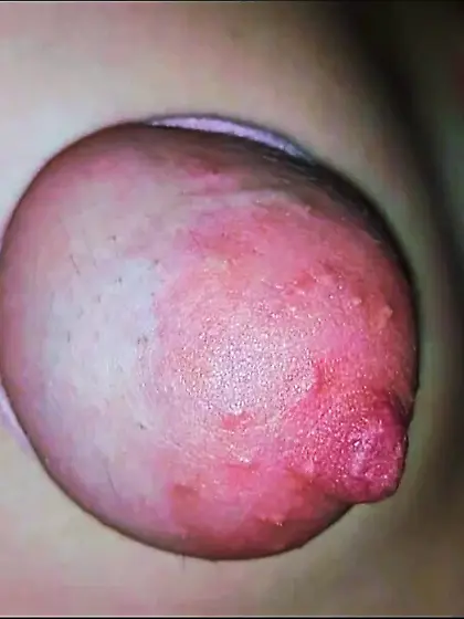 18 year old pussy rip