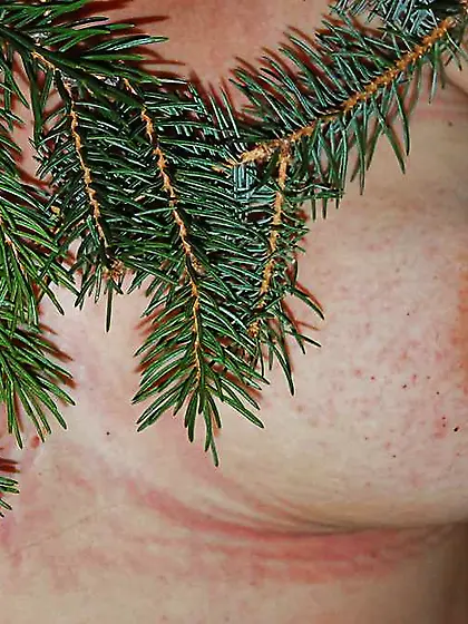 Walk with the nettles...