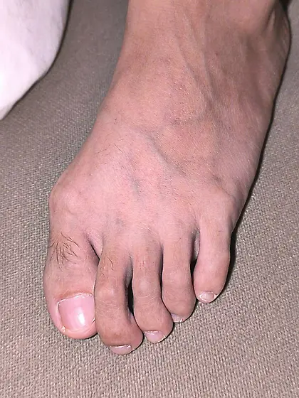 Feet at a hot spring rest area