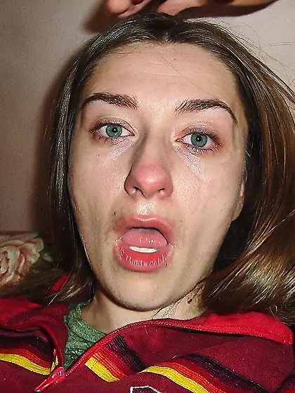 polish girl - teary facial