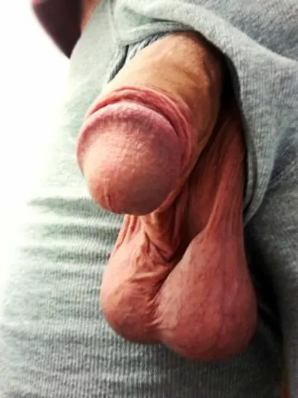 balls that have dropped