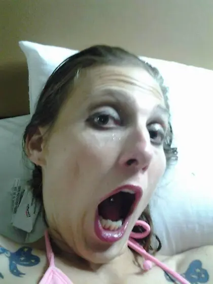 skinny meth girl uncomfortable