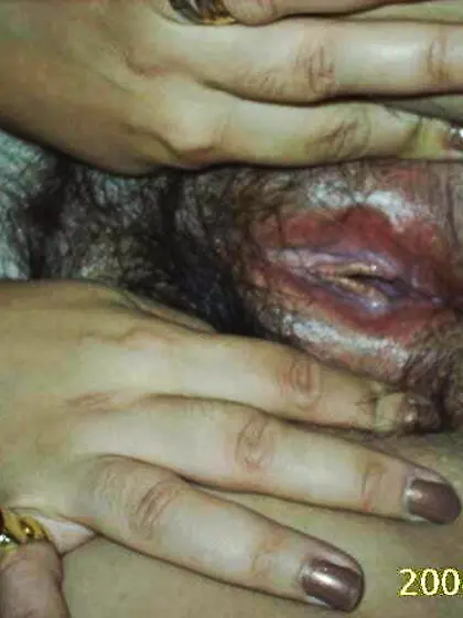 Te tengo en mi mano,  Te chupo, Estás demasiado exq