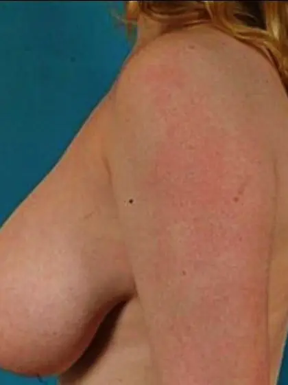 Amy - 20yr old,  36G