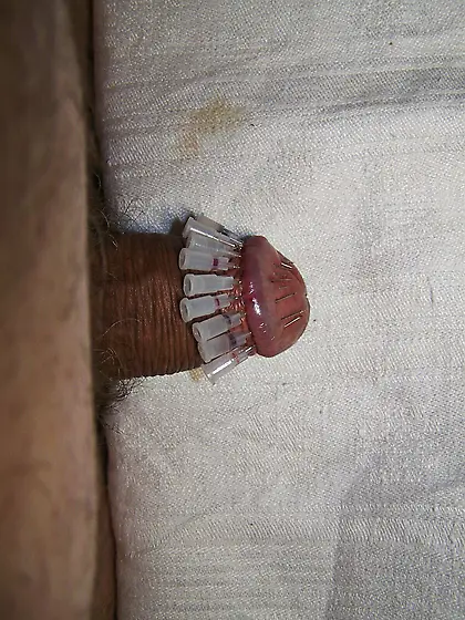 Glans crown