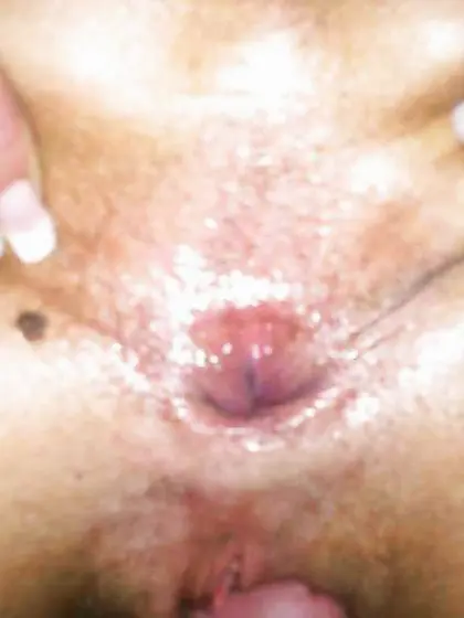 Mies in den arsch gefickt