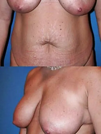 Supreme boobs that make me rigid