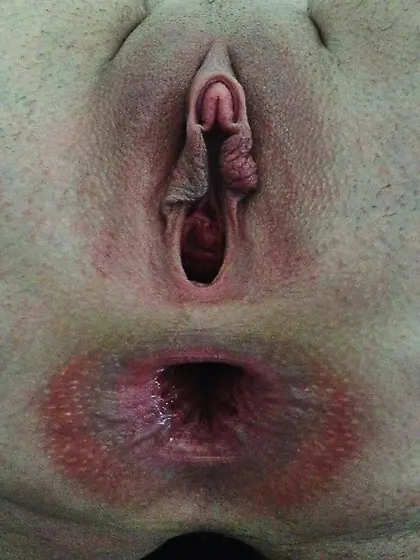 Mutilated FTM Detrans Sissy <3