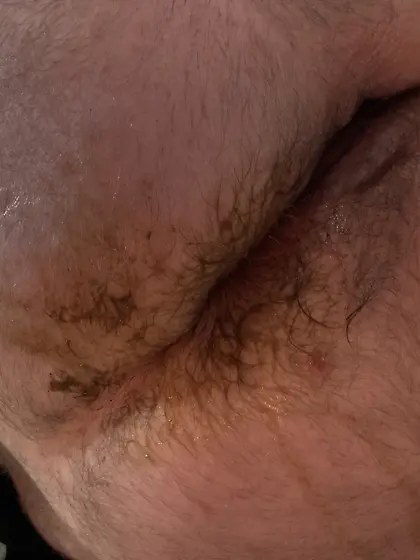 Loose anal shit slut