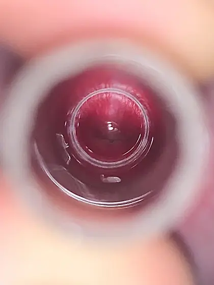 Stretched open urethra